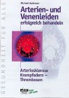 behandlung krampfadern